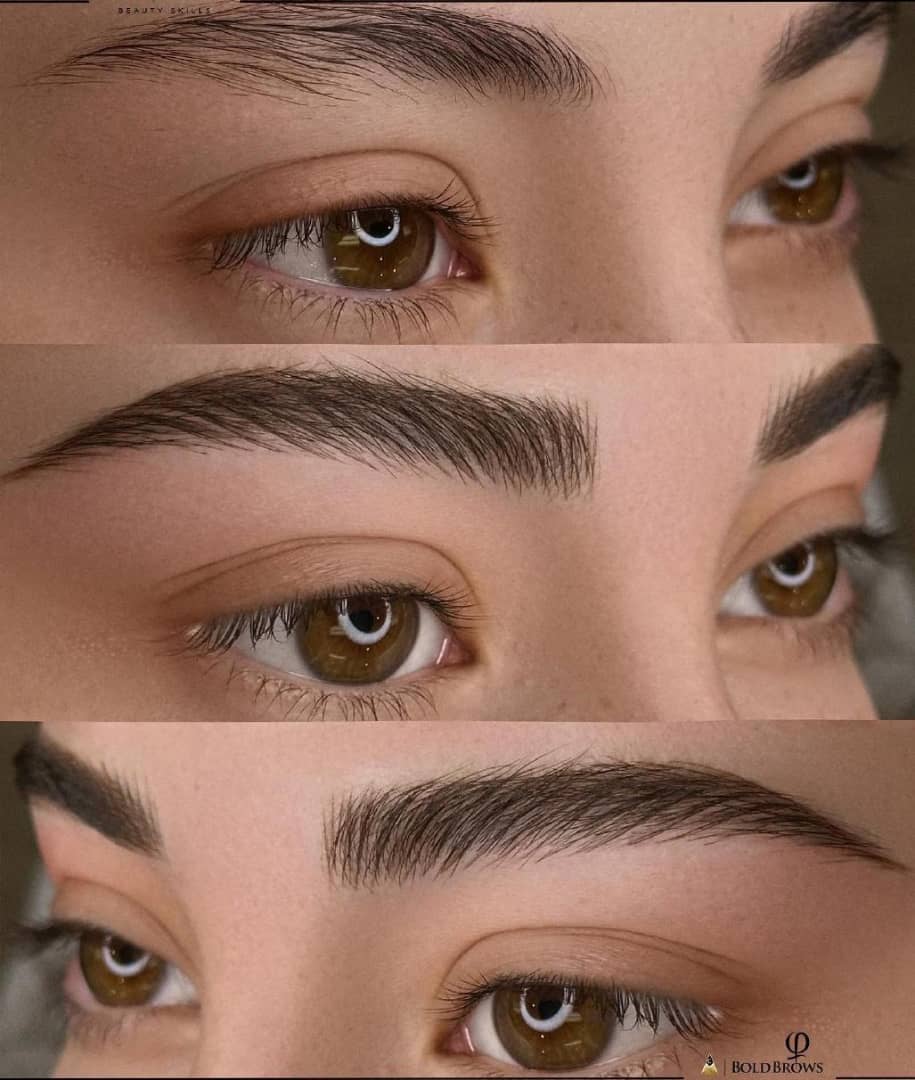 فیبروز ابرو